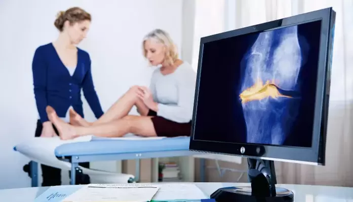 artrose da articulação em uma mulher